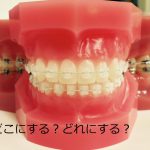 矯正歯科の選び方（矯正相談編）